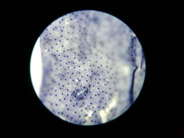 Simple Squamous Epithelium Slides - Simple Squamous Epithelium 04 100X
